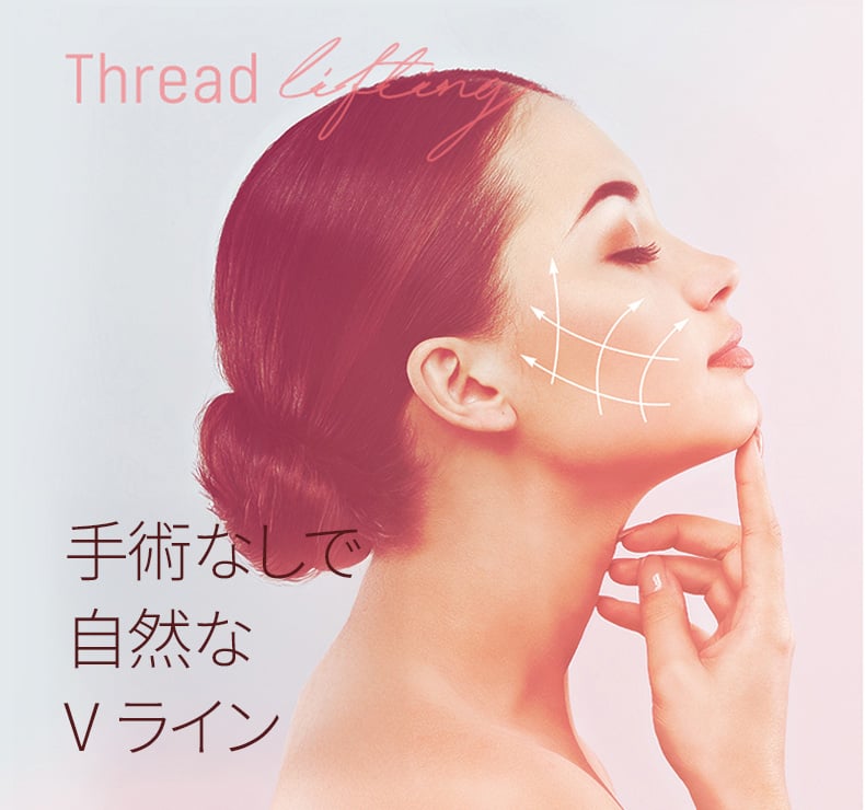 スレッドリフティング