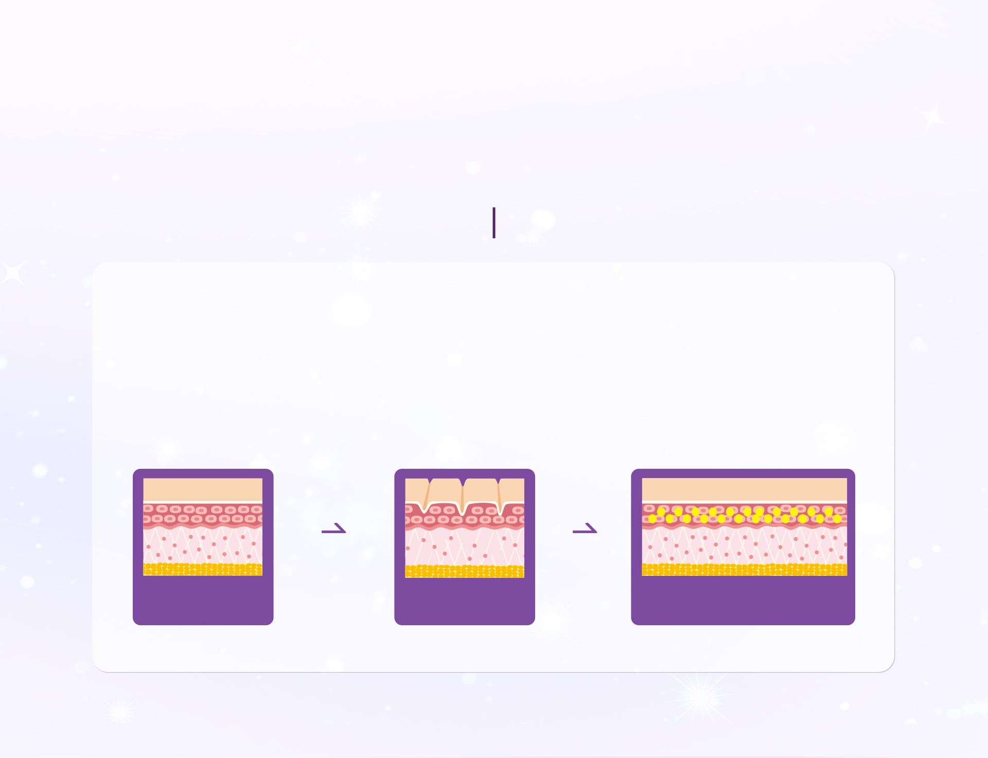 エバークル効果のご案内