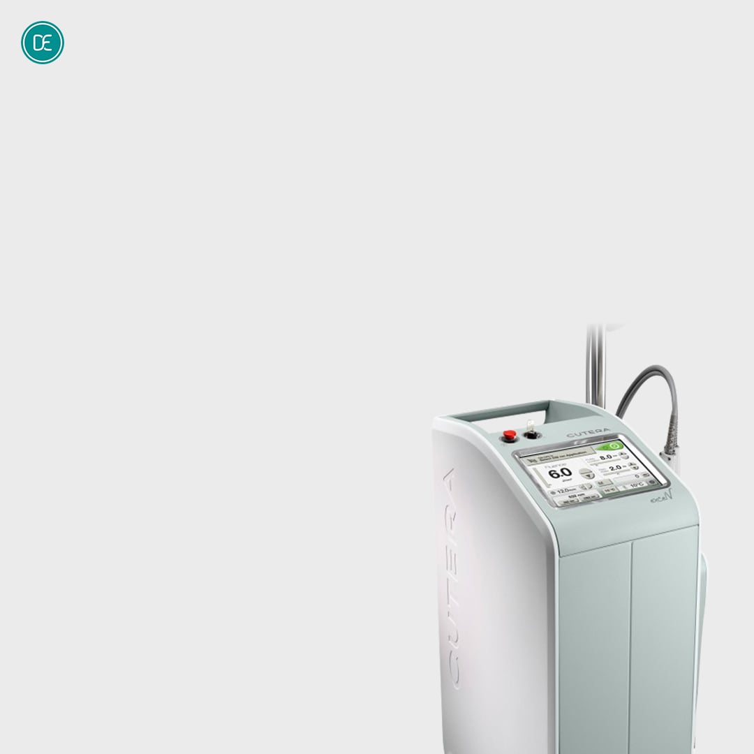 エクセルV